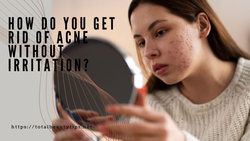 How do you get rid of acne without irritation?